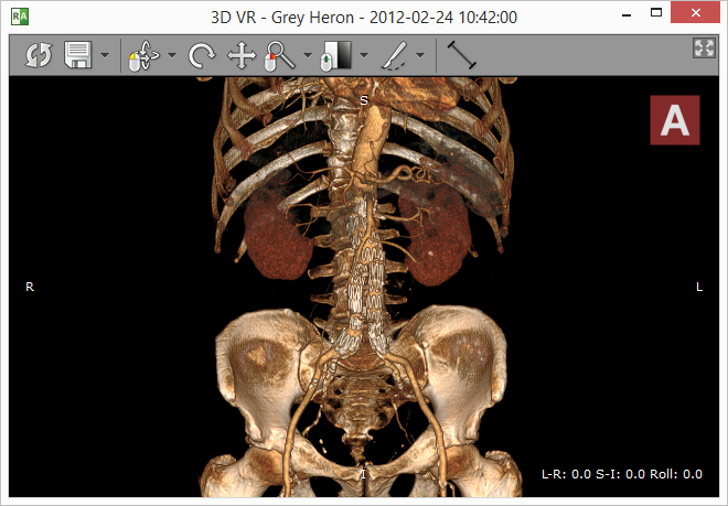 RadiAnt DICOM Viewer 