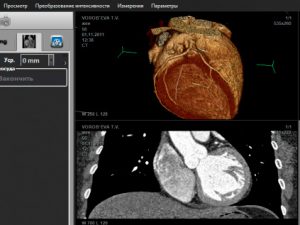 MultiVox DICOM Viewer