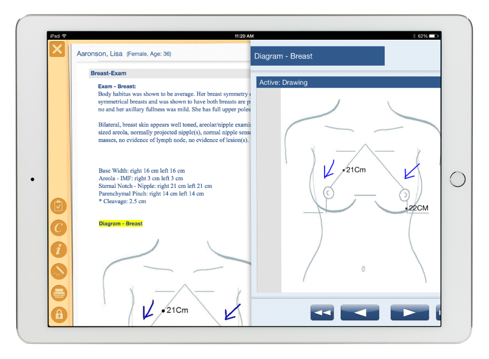 Nextech Practice характеристики