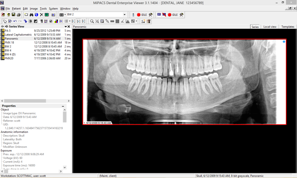 MiPACS Storage Server ПО