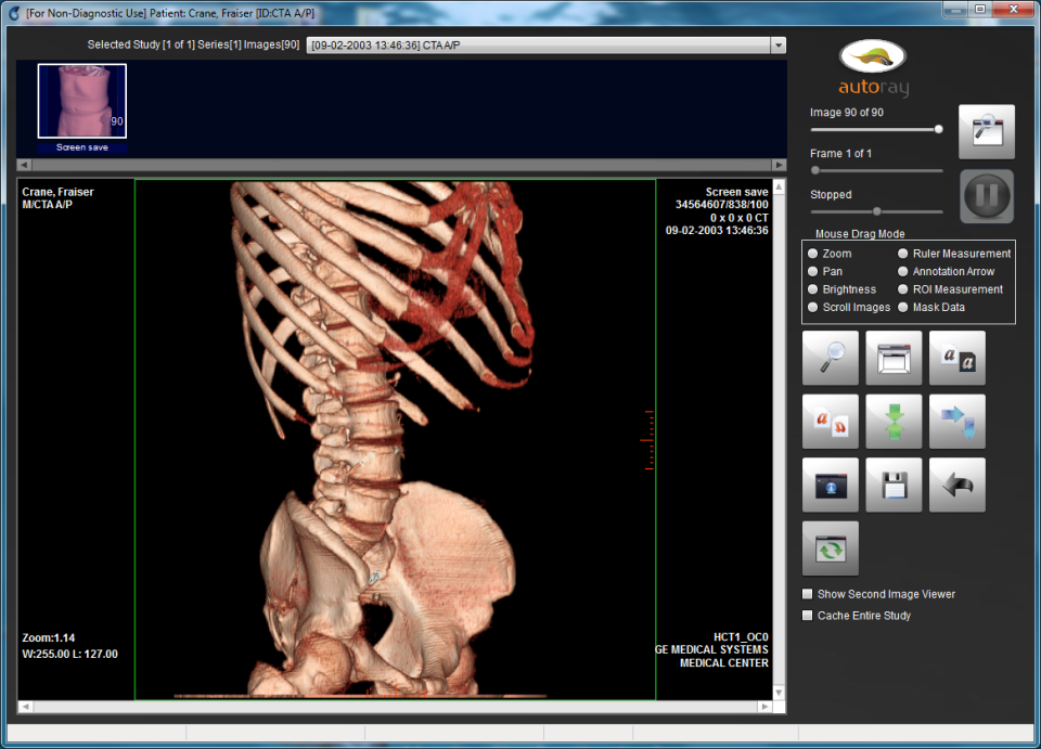 MatrixRay характеристики