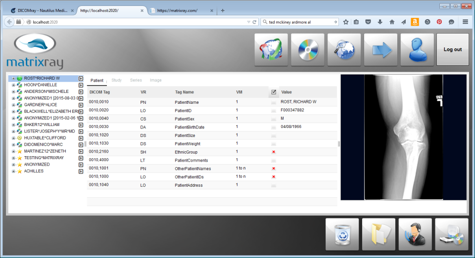 MatrixRay подбор