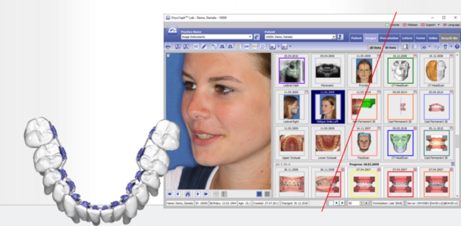 Onyx Ceph программа