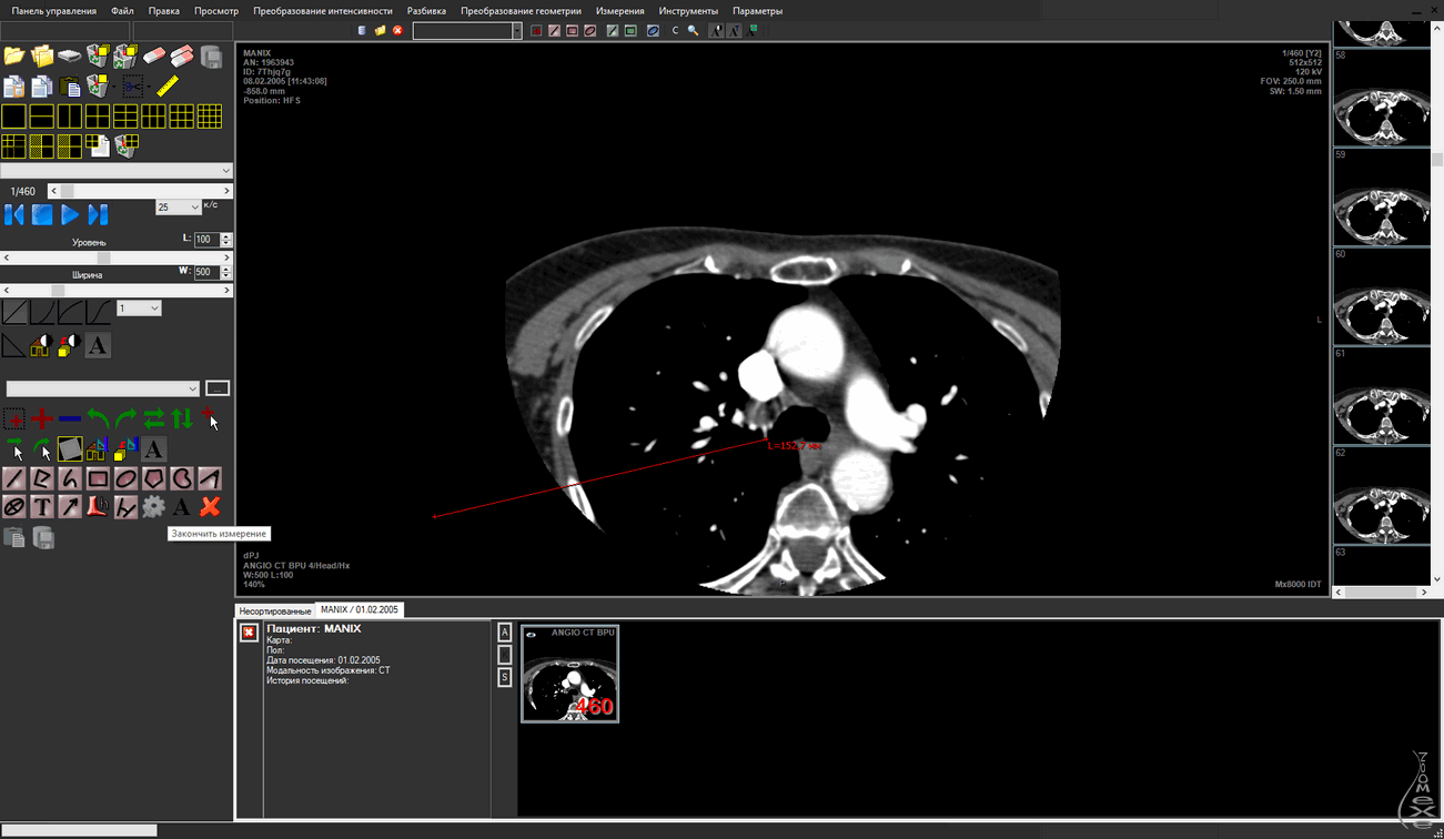 MultiVox DICOM Viewer
