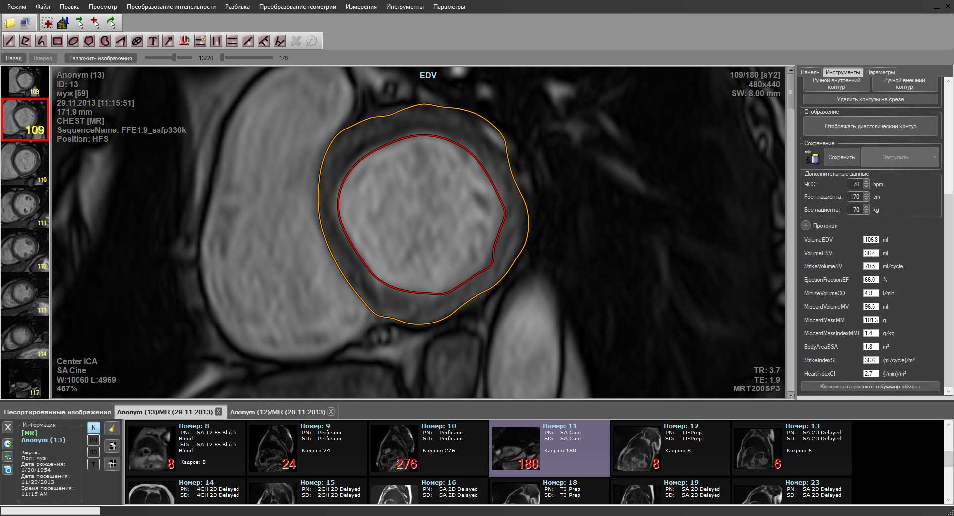 MultiVox DICOM Viewer