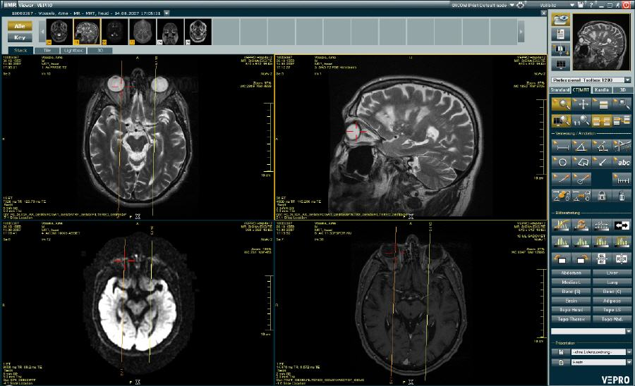 VEPRO PACS/EMR характеристики