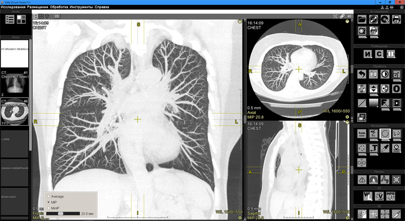 Vidar Dicom Viewer программа