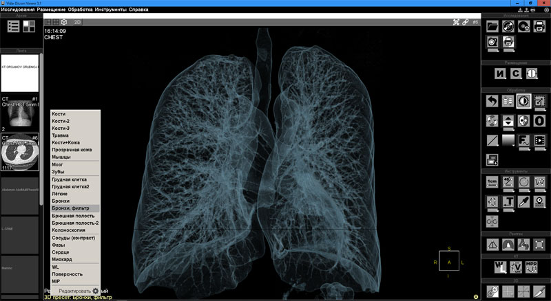 Vidar Dicom Viewer ПО