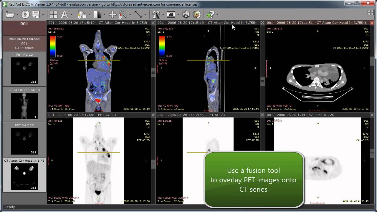 RadiAnt DICOM Viewer 