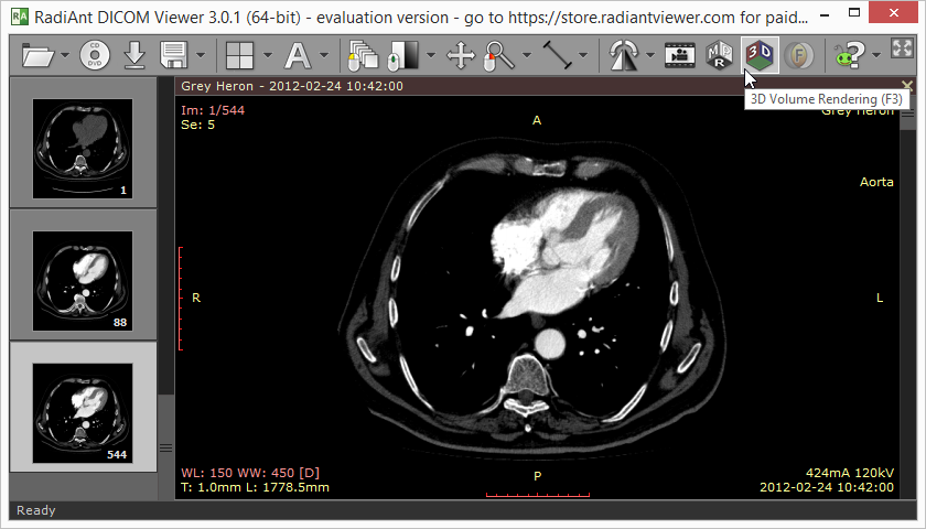 RadiAnt DICOM Viewer 