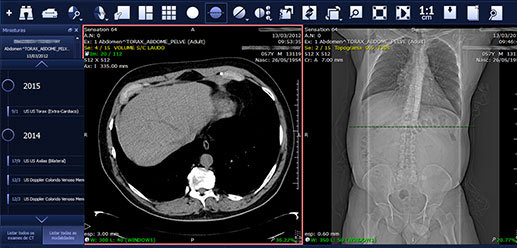 Pixeon PACS программа