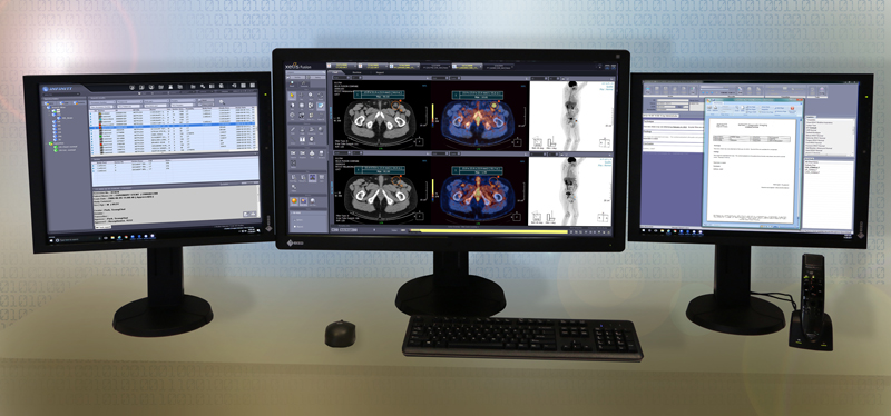 Infinitt RIS/PACS программа