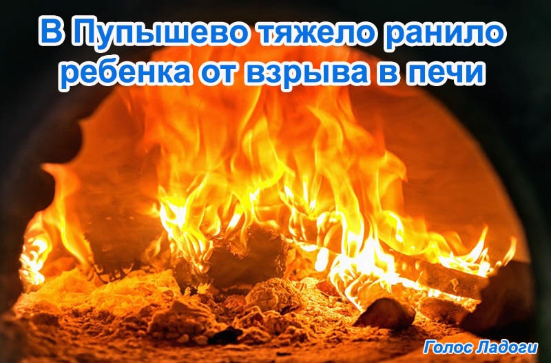 В Пупышево тяжело ранило ребенка от взрыва в печи