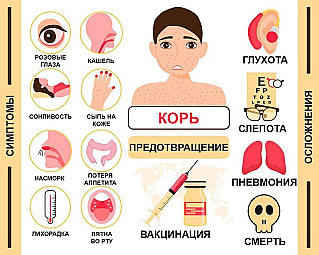 Корь крайне опасна заразностью и осложнениями