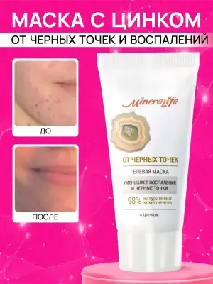 Маска для лица от черных точек и прыщей для проблемной кожи
