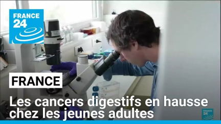 France : les cancers digestifs en hausse chez les jeunes adultes • FRANCE 24