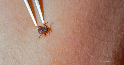 Maladie de Lyme : l’existence de symptômes persistants est une réalité, insiste la Haute autorité de santé